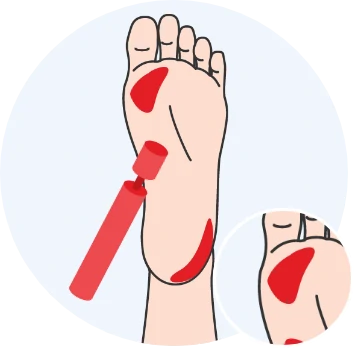 pedicure podologiczne w myślenicach